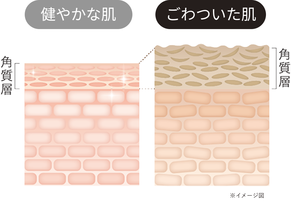 健やかな肌とごわついた肌図