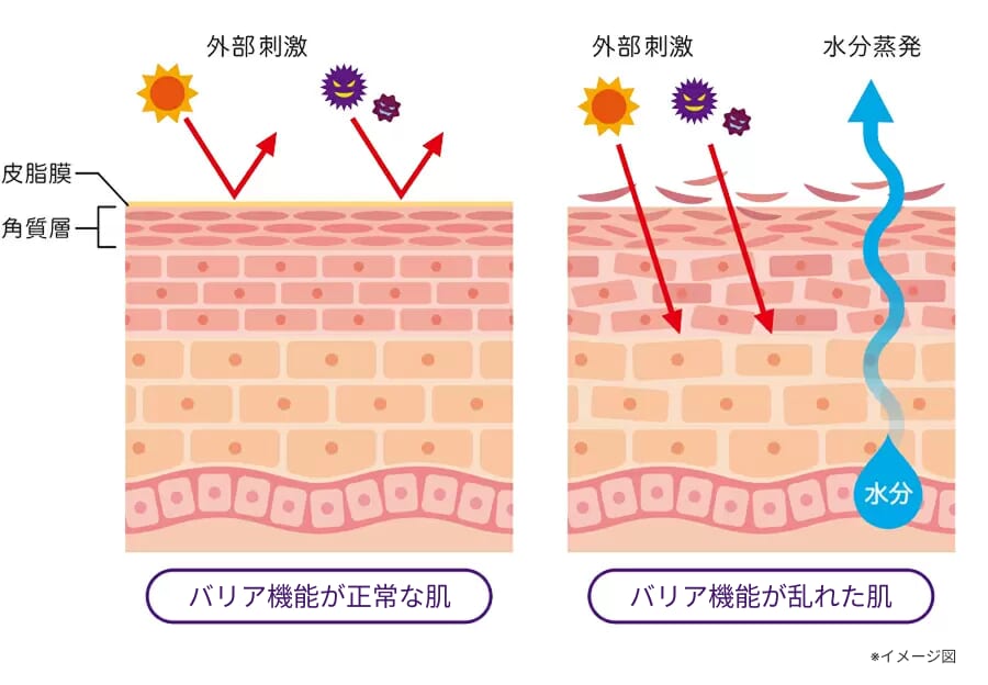 図解_バリア機能が正常な肌と壊れた肌の比較イラスト_200115_03.jpg（編集済み）
