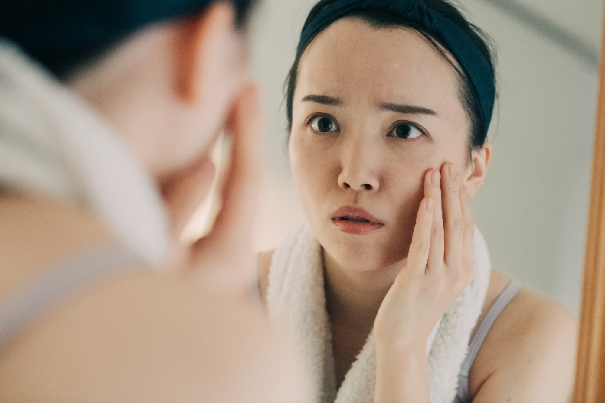 肌あれに悩む女性