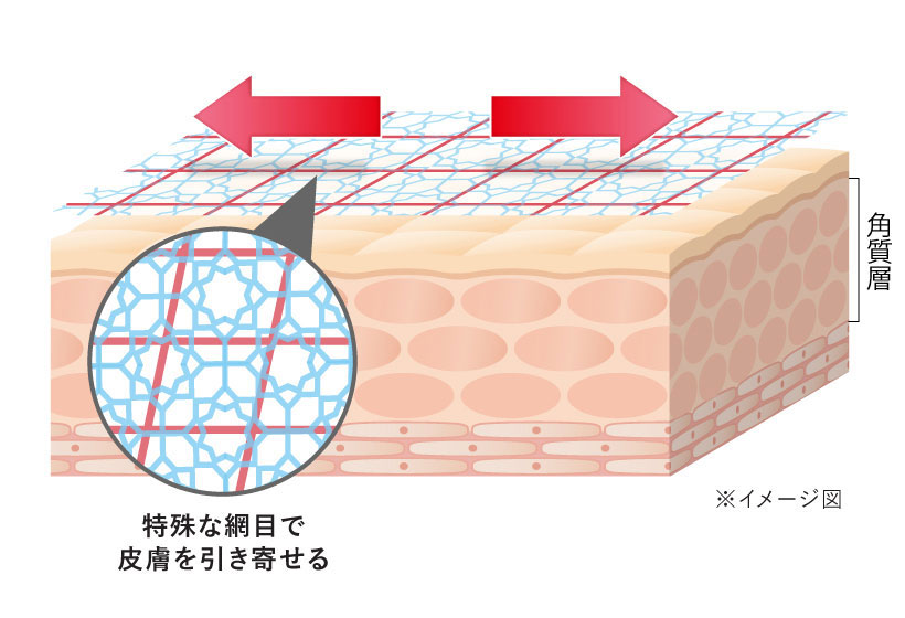 特殊な網目で皮膚を引き寄せるイメージ図