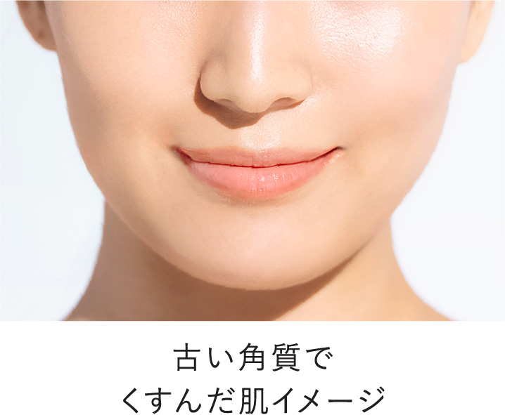 古い角質でくすんだ肌イメージ