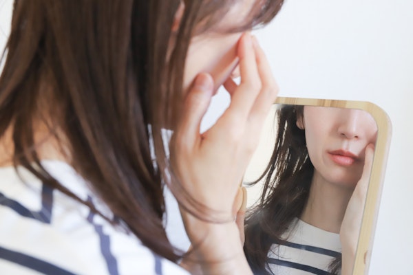 肌あれに悩む女性