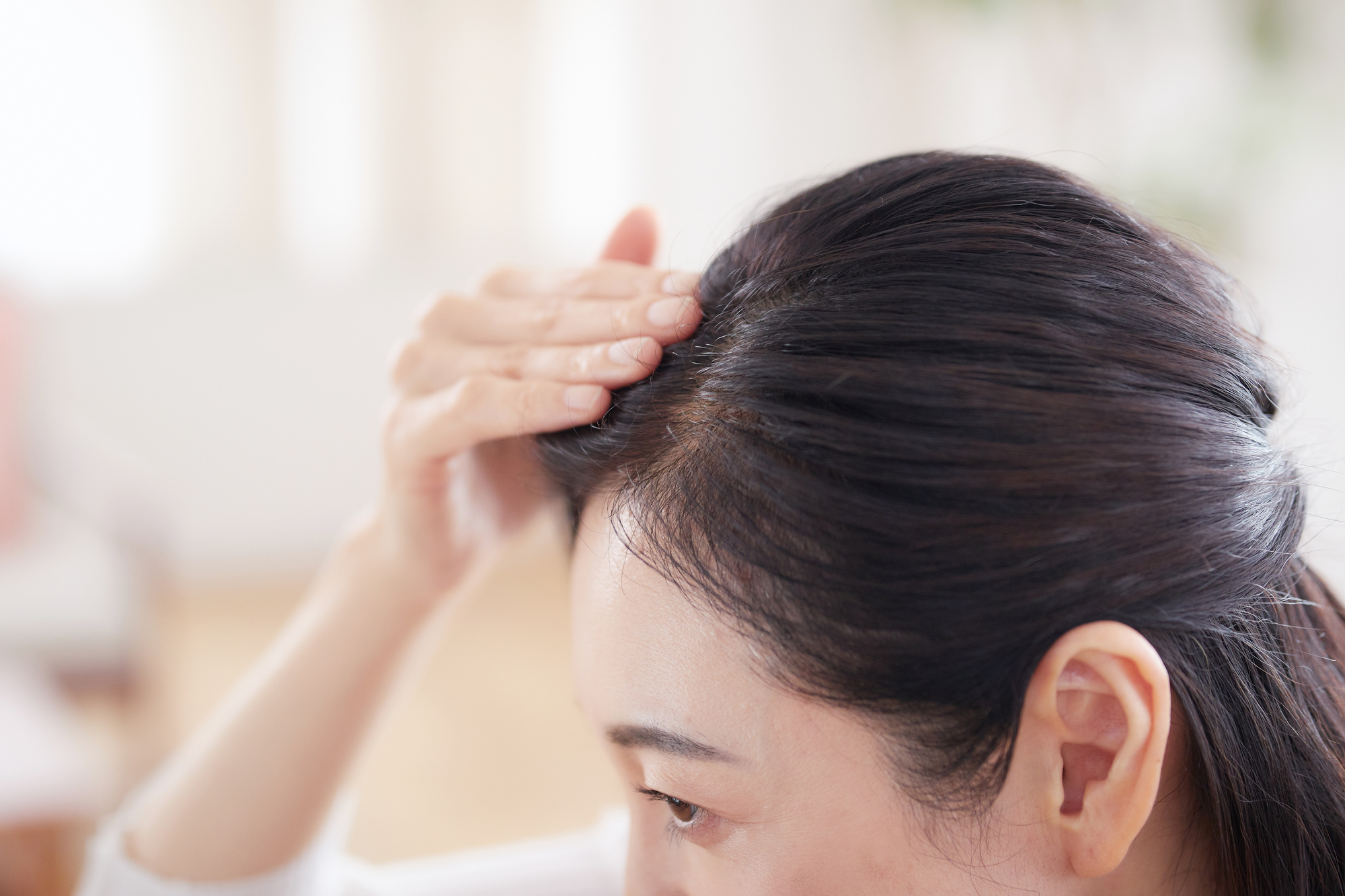 生え際を気にする女性