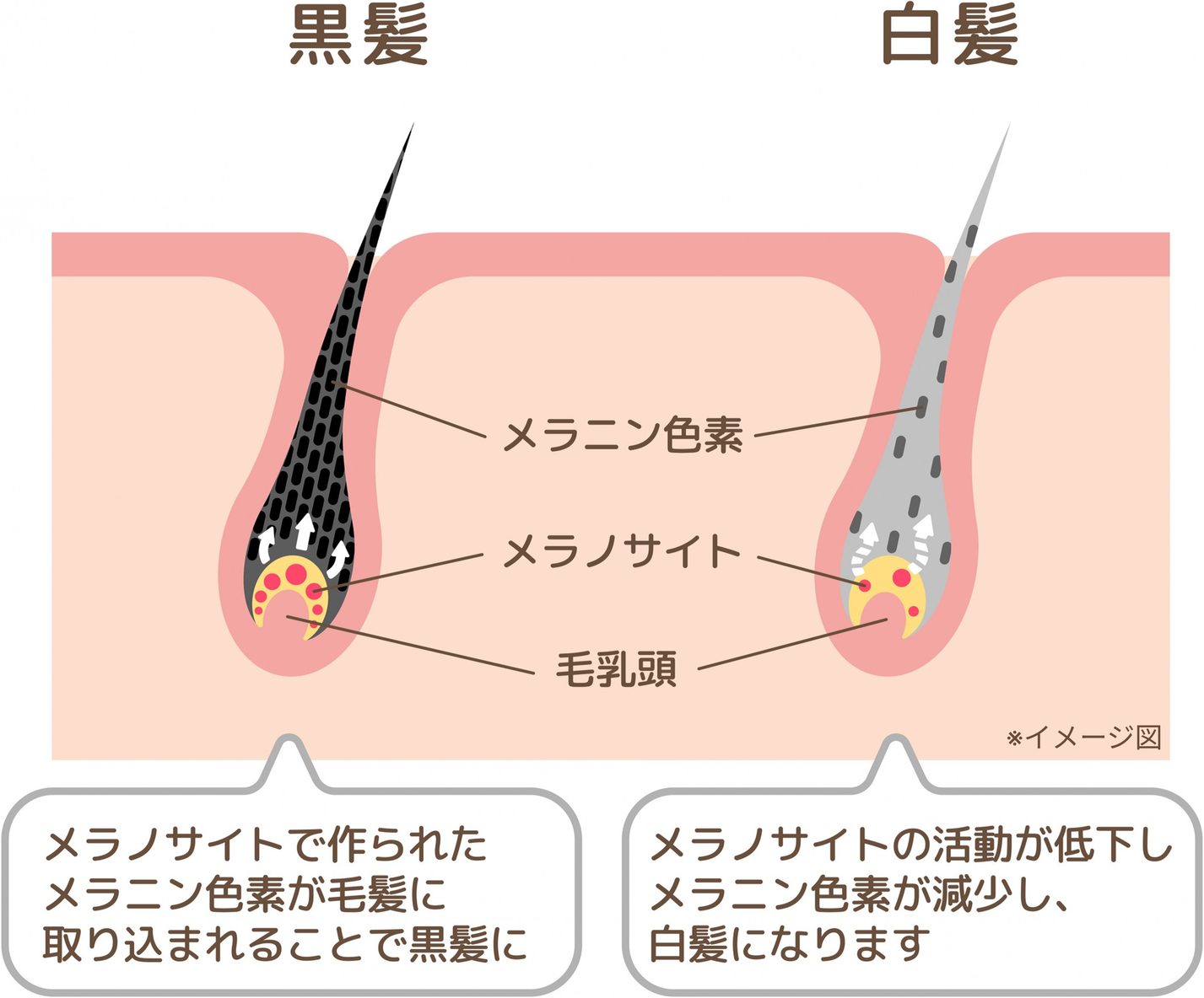 黒髪と白髪の頭皮状態の比較図