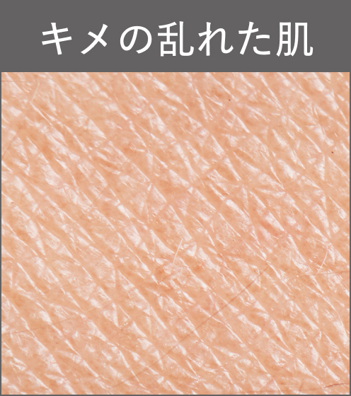 キメの乱れた肌