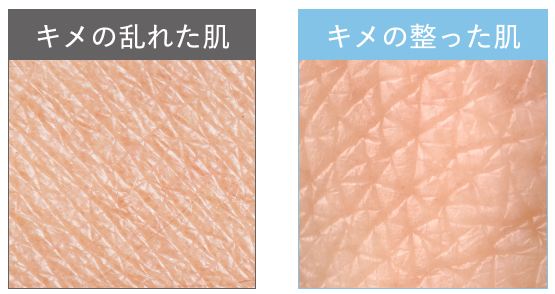 キメの乱れた肌とキメの整った肌