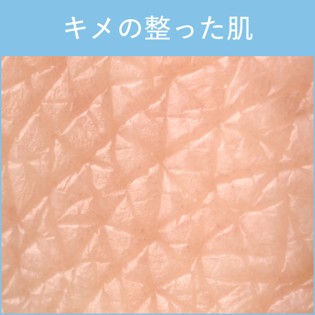キメの整った肌