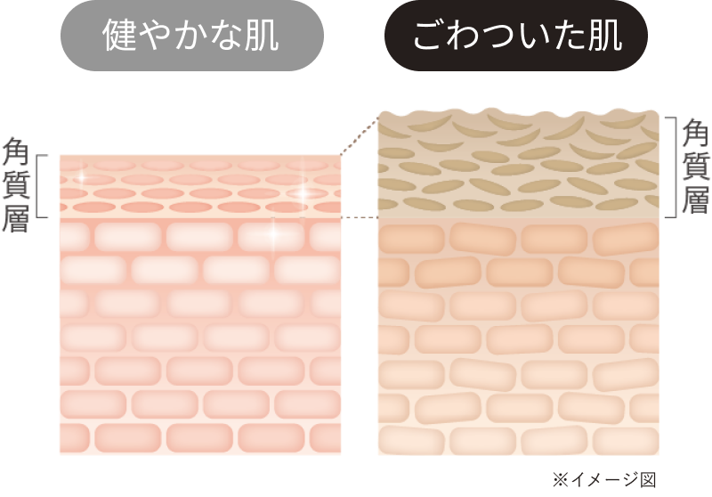 健やかな肌とごわついた肌図
