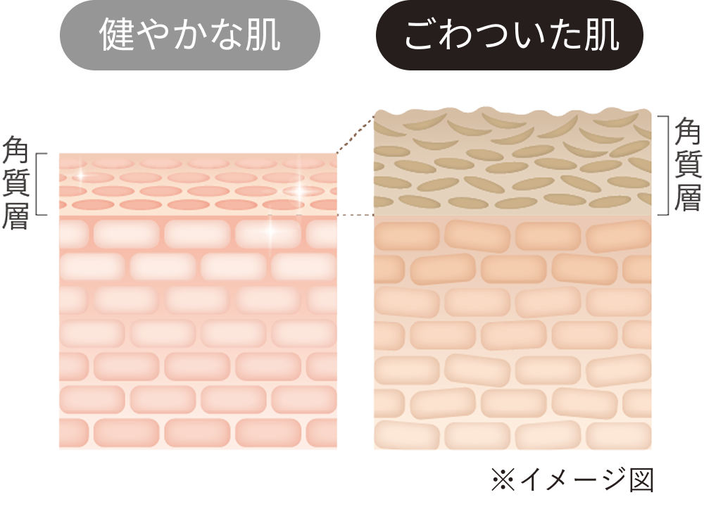 健やかな肌とごわついた肌