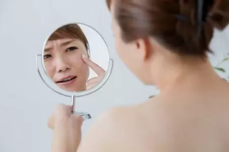 Lỗ chân lông chảy xệ là gì?