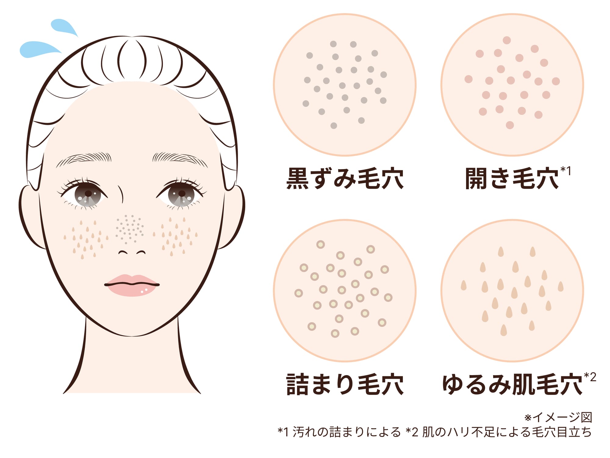 イラスト_毛穴悩みの種類