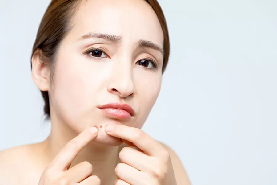 Các vấn đề do vệ sinh không đủ