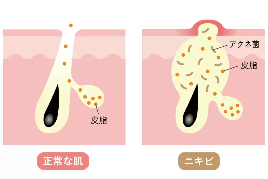 Nó có thể gây ra các vấn đề về da