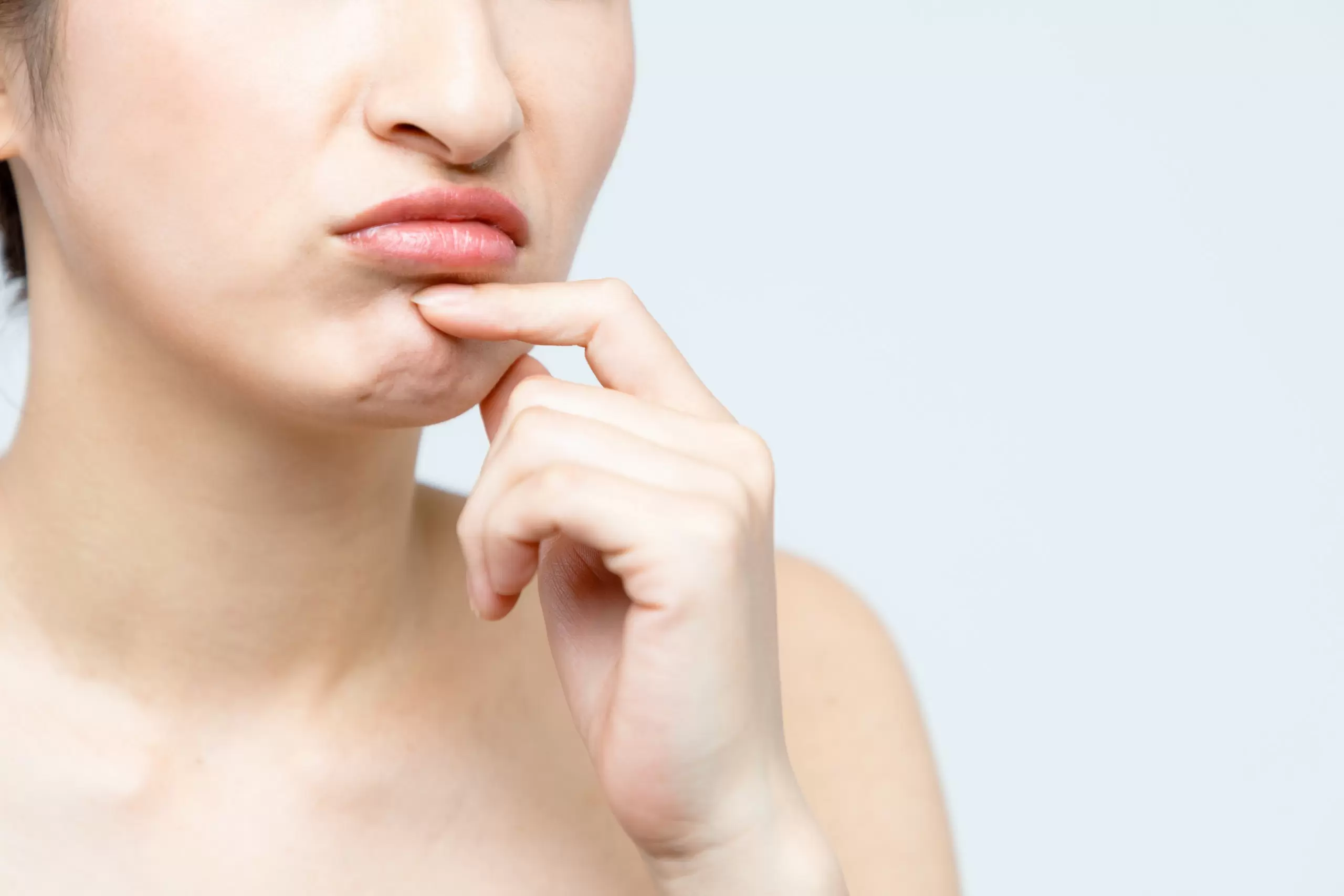 Nguyên nhân gây ra mụn dưới cằm và quanh mặt