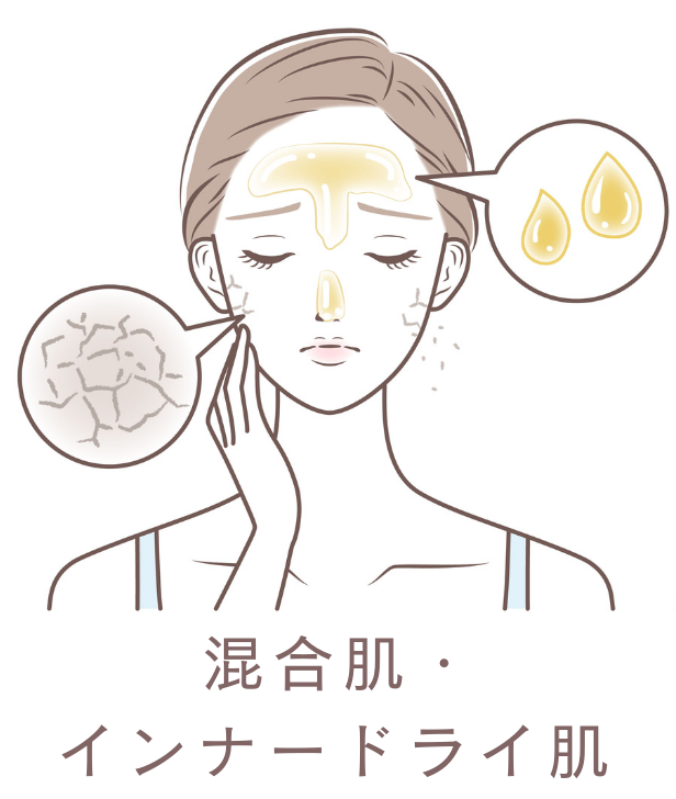 肌質タイプ_混合肌・インナードライ肌