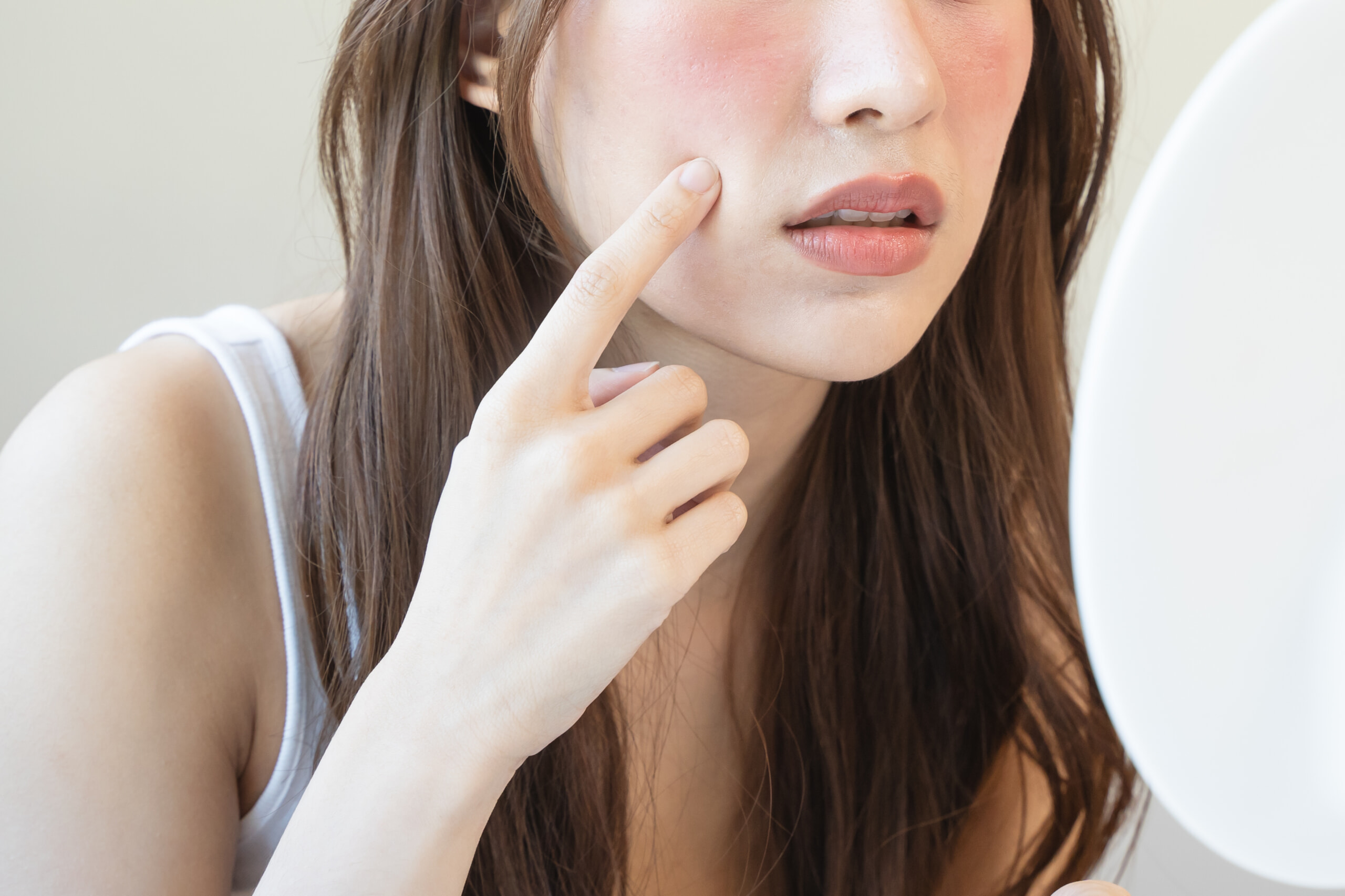 肌あれを気にする女性