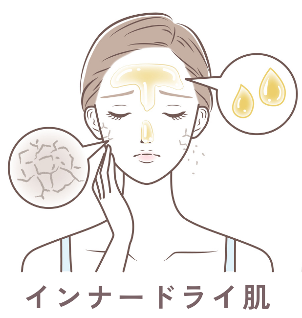 イラスト_インナードライ肌