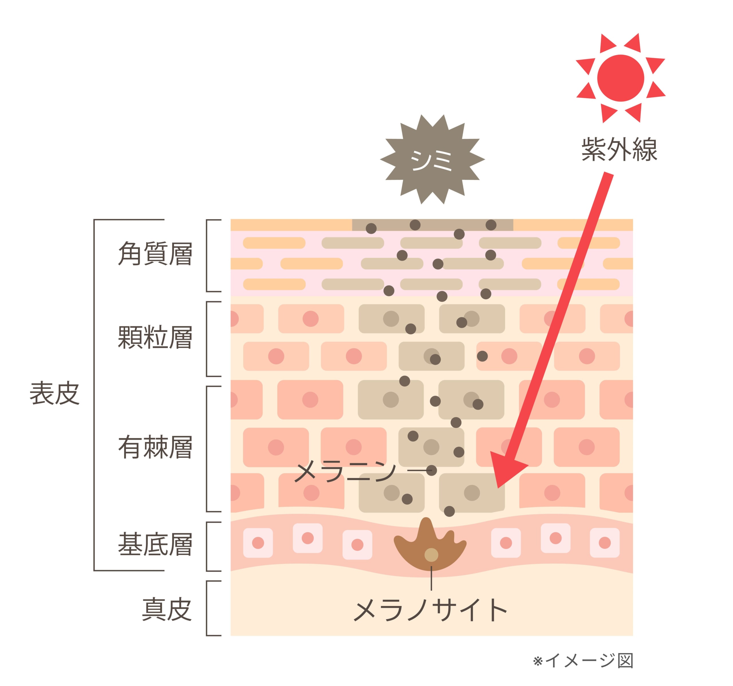 解説イラスト_シミができるメカニズム