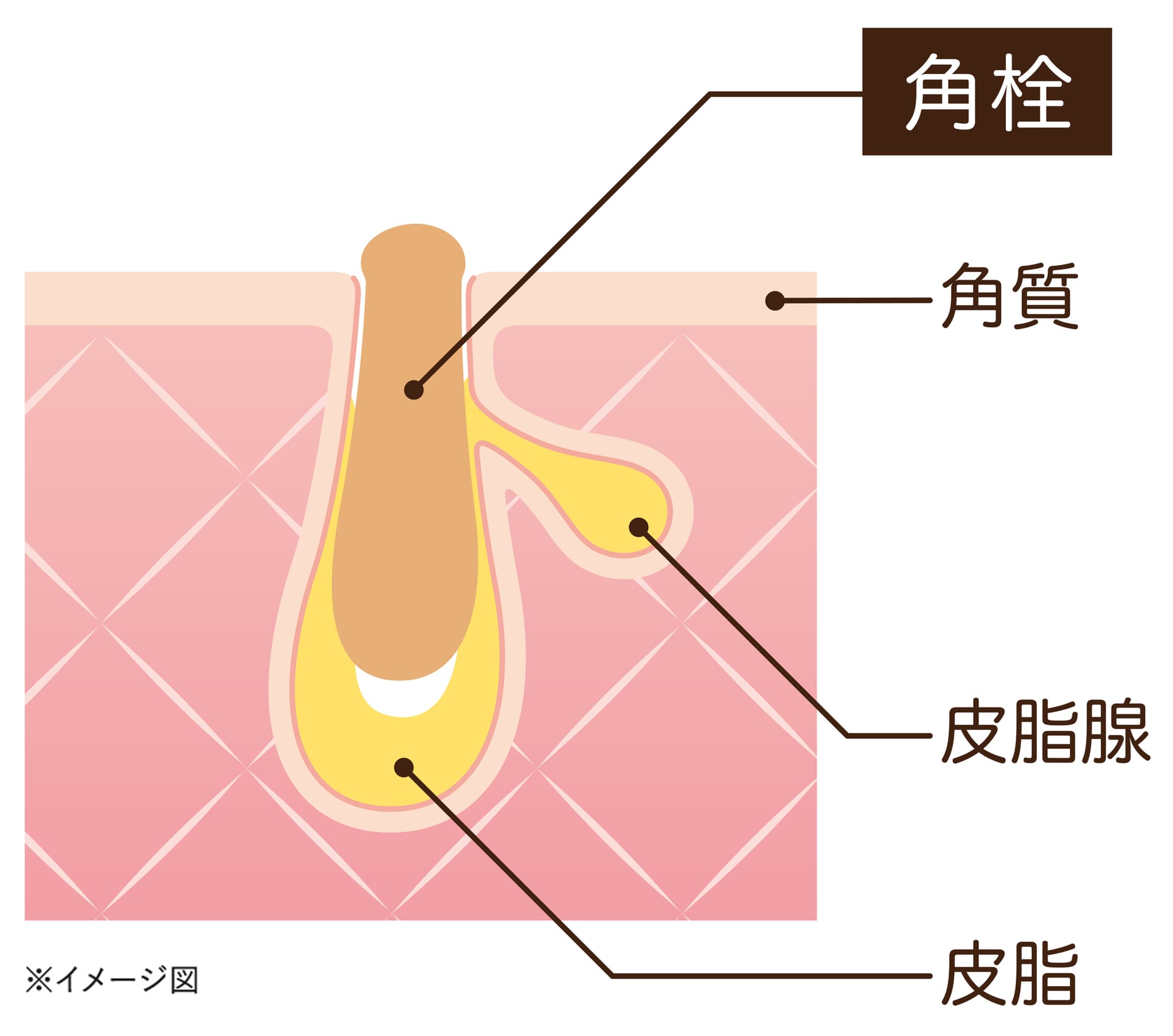 毛穴の断面図
