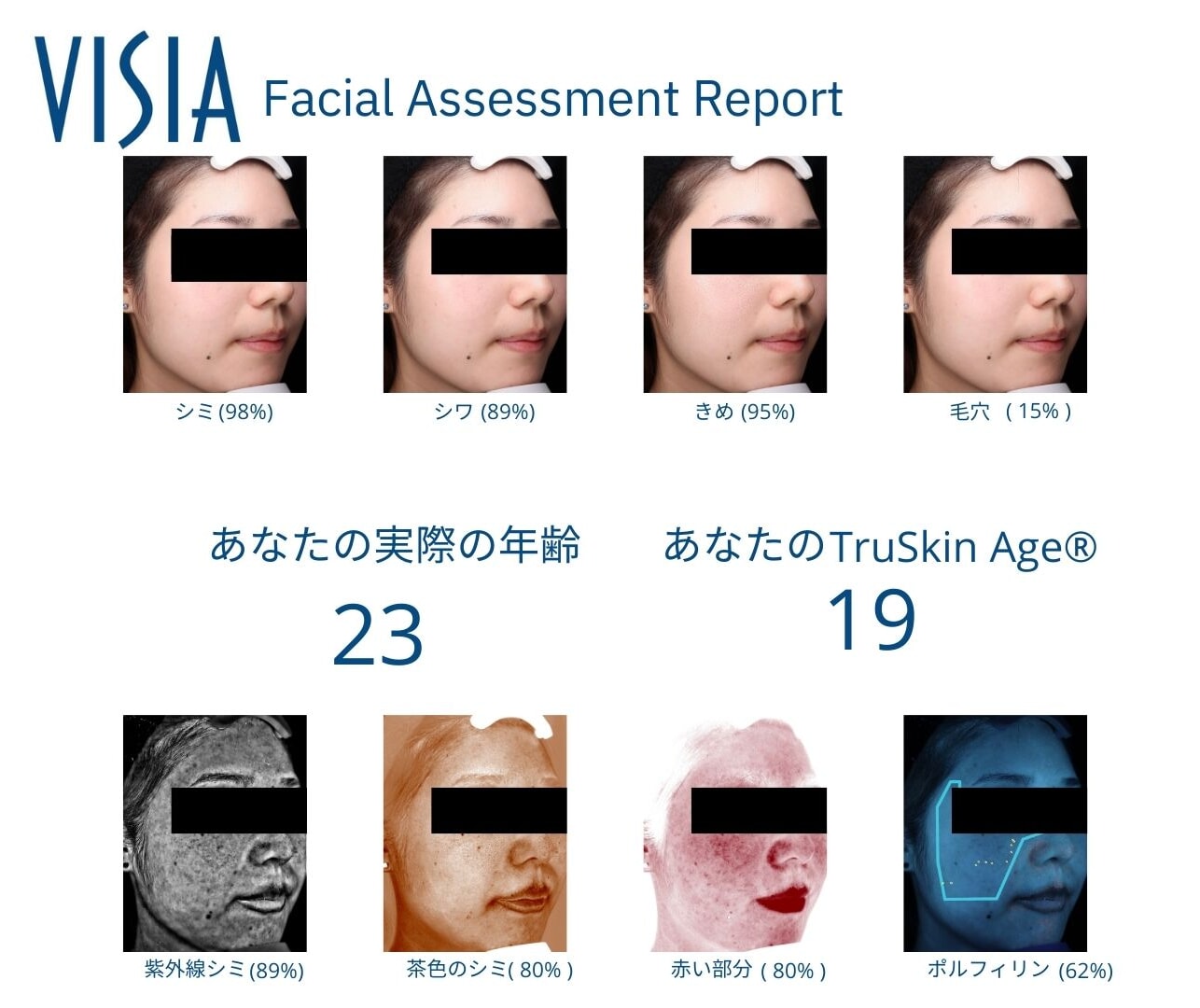 VISIAによる診断結果の図