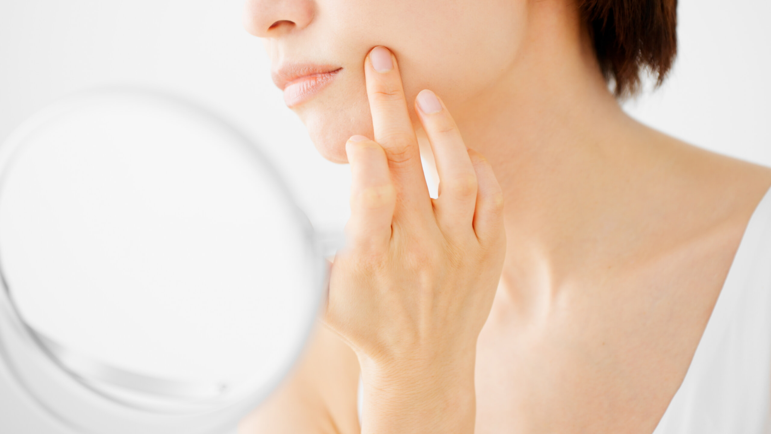 肌あれに悩む女性