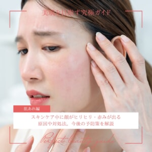 スキンケア中に顔がヒリヒリ・赤みが出る原因や対処法。今後の予防策を解説