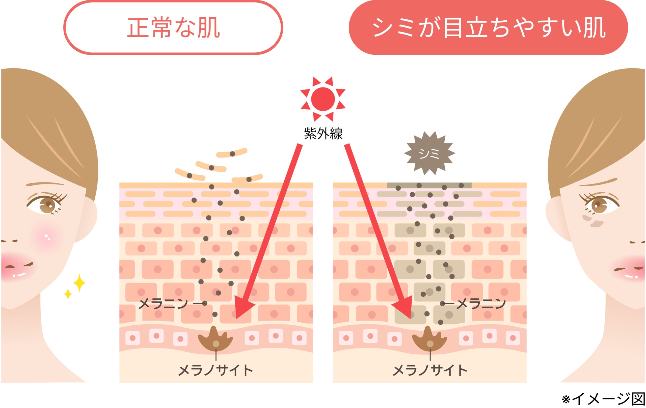 図解_シミができるメカニズム