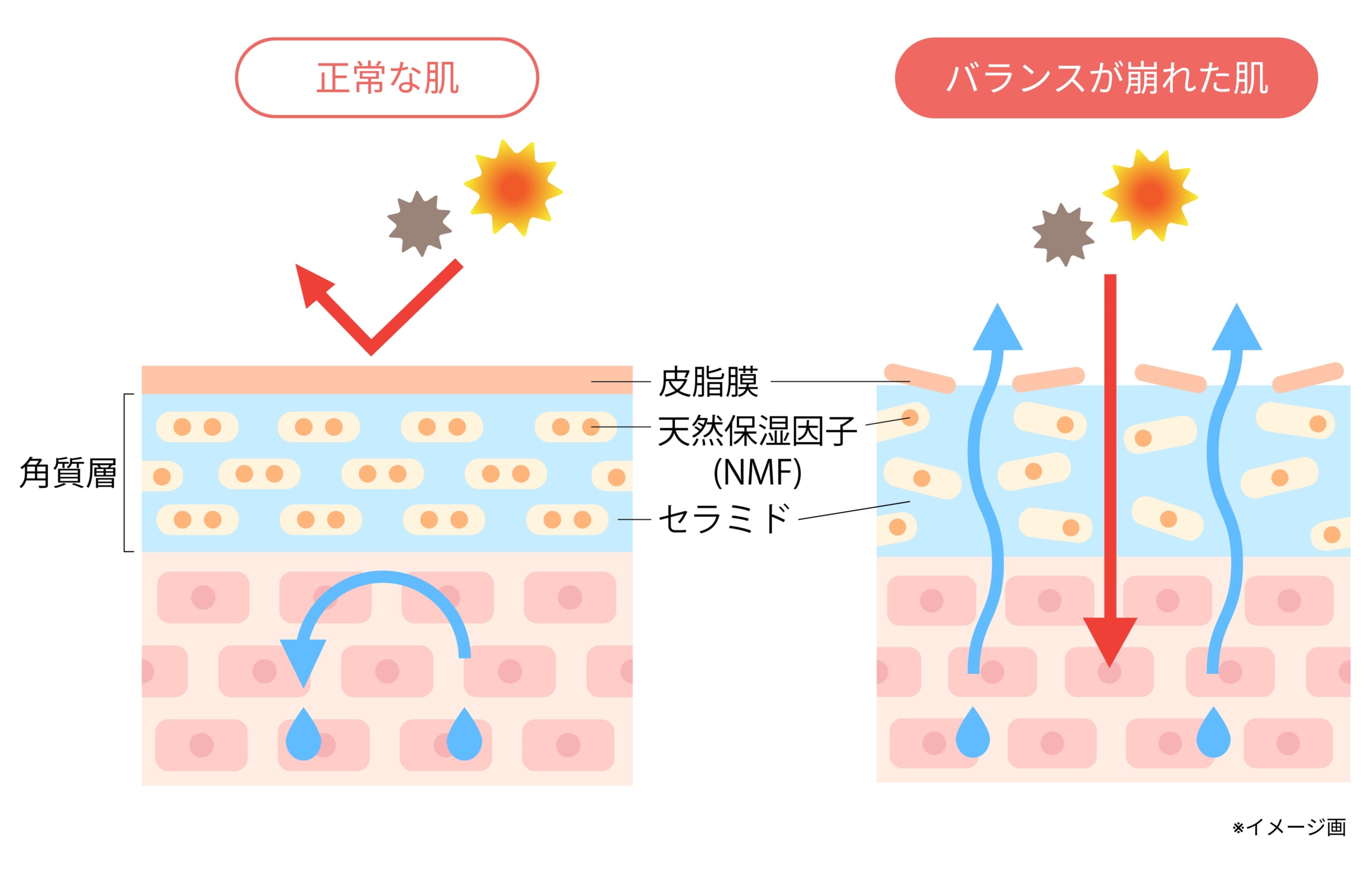 比較イラスト_水分バランスの正常な肌と崩れた肌