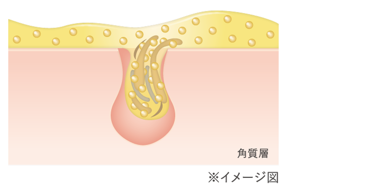 クレンジングが肌になじみ汚れが角栓ケア成分に絡まって