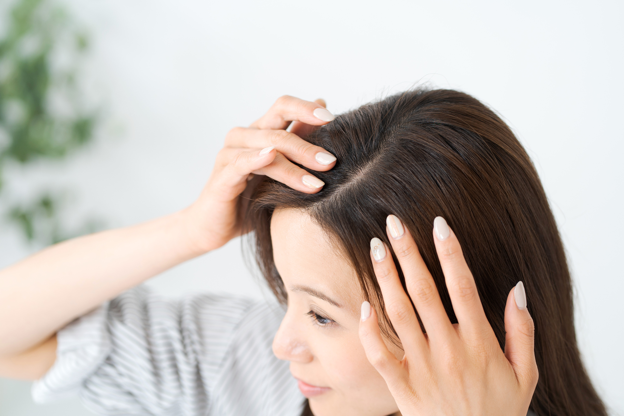 生え際を気にする女性