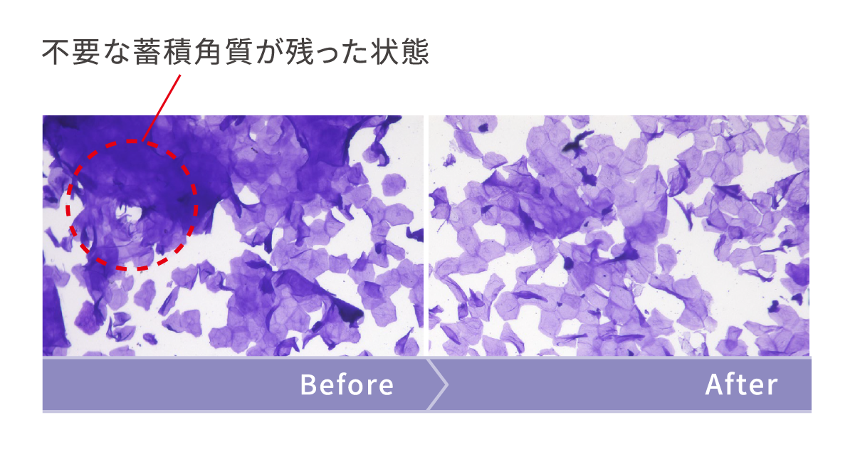 不要な蓄積角質が落ちた