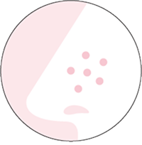 ひらき