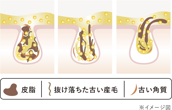 角栓溶解オイルが毛穴づまりを溶かして落とす