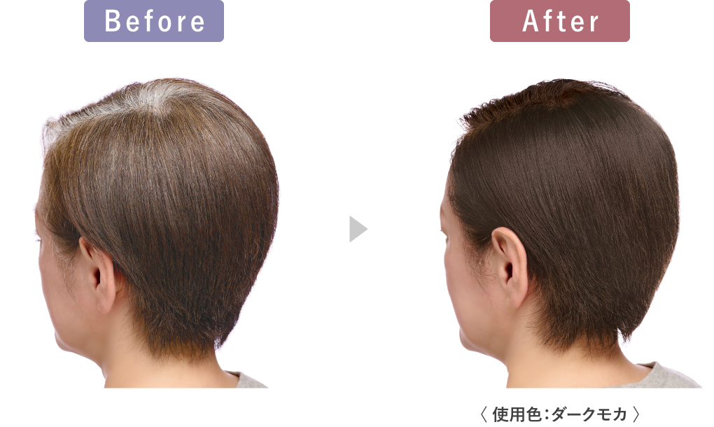 Before After