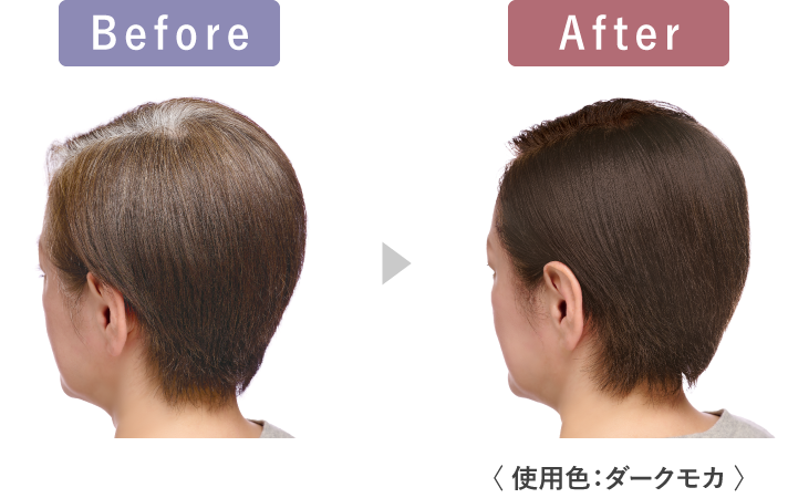 Before After