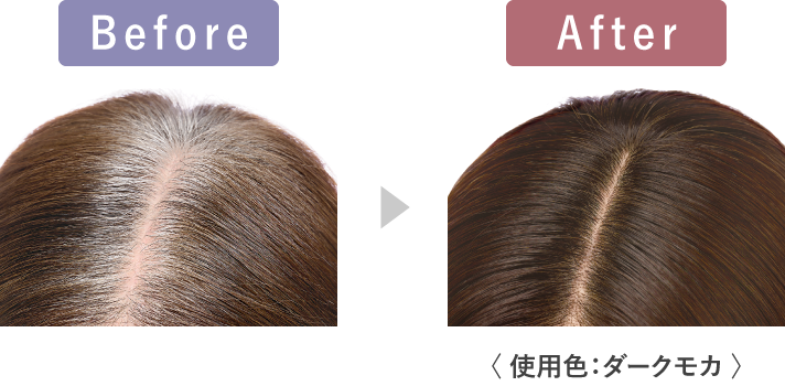 Before After