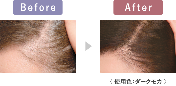 Before After